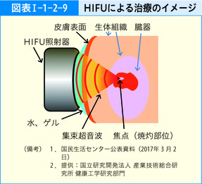 図表Ⅰ-1-2-9 HIFUによる治療のイメージ