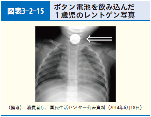 図表3-2-15 ボタン電池を誤飲した１歳児のレントゲン写真