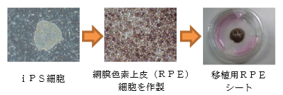 iPS細胞由来網膜色素上皮（RPE）シートの作製