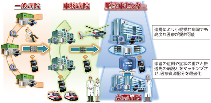 図表3-3-1-6 病院間の情報連携のイメージ（脳卒中の例）