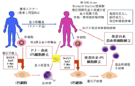 図7 iPS細胞による遺伝性出血疾患の根治治療