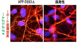 図11 神経細胞内に蓄積したAβの様子